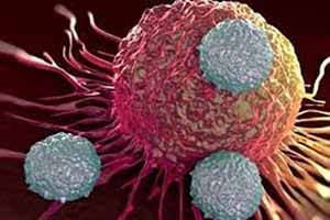 تولید نانوذراتی که تومور سرطانی را می‌سوزاند